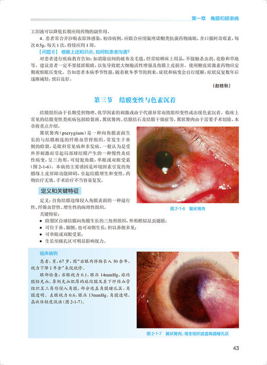 眼科学 第2版 王宁利 沈晔主编 国家卫生健康委员会住院医师规范化培训规划教材 配增值线上数字内容 人民卫生出版社9787117339162 商品图3