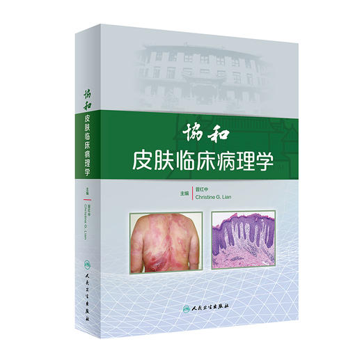 协和皮肤临床病理学 晋红中 主编 皮肤组织学 感染相关性皮肤病 皮损形态分类皮肤病 皮肤肿瘤等内容 人民卫生出版社9787117287371 商品图1