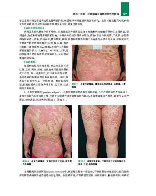 协和皮肤临床病理学 晋红中 主编 皮肤组织学 感染相关性皮肤病 皮损形态分类皮肤病 皮肤肿瘤等内容 人民卫生出版社9787117287371 商品图2