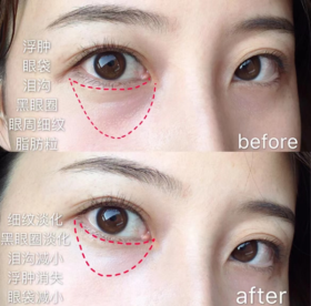 清仓大捡漏！2.6折薅马应龙眼霜！440年眼药世家，抹走眼纹、黑眼圈