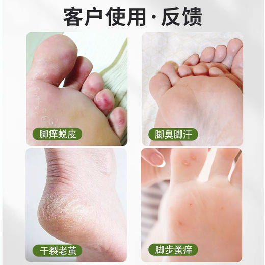 【1瓶适合多种足部问题】白云山足气净喷剂 足气水 干痒干裂脱皮 脚汗脚臭止痒脱皮喷剂 足气灵喷剂 35ml/瓶 商品图3