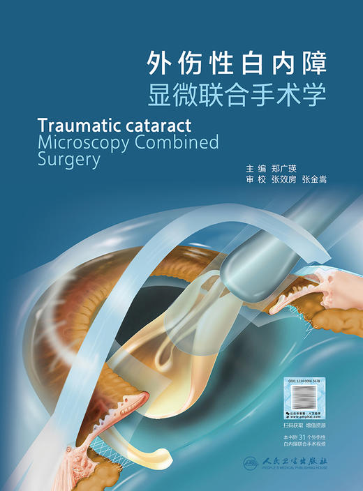 外伤性白内障显微联合手术学 2023年8月参考书 9787117347204 商品图1