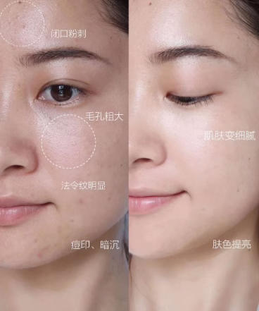 【8.26大牌再降价】润百颜水油双效次抛套组40支（玻尿酸水润次抛30支+奢养次抛精华油10支） 商品图5