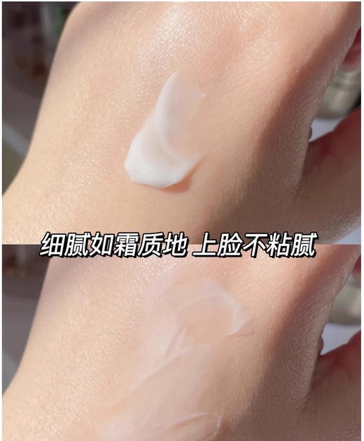 【2.2王炸割肉价】资生堂悦薇水乳套装醇润水30ml+醇润乳15g（限24年3月） 商品图3