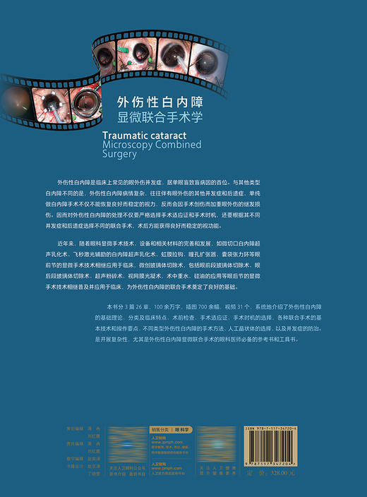 外伤性白内障显微联合手术学 2023年8月参考书 9787117347204 商品图2