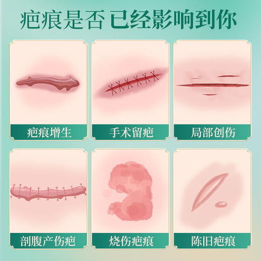 【品牌方直销】云南本草去疤膏去痕修复除疤膏医用硅酮凝胶增生儿童烫2fl 商品图1