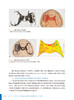 数字化技术在可摘局部义齿修复中的应用 吴江 高勃 金属3D打印技术制作可摘局部义齿基础研究临床应用 口腔修复学 人民卫生出版社 商品缩略图4