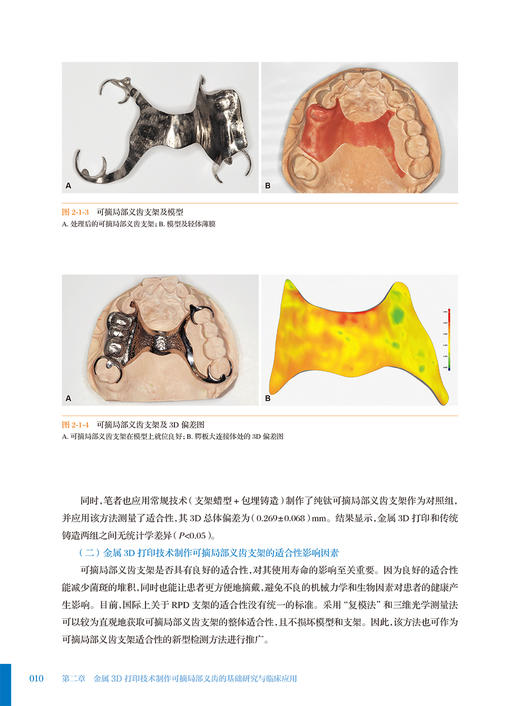数字化技术在可摘局部义齿修复中的应用 吴江 高勃 金属3D打印技术制作可摘局部义齿基础研究临床应用 口腔修复学 人民卫生出版社 商品图4