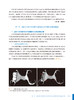 数字化技术在可摘局部义齿修复中的应用 吴江 高勃 金属3D打印技术制作可摘局部义齿基础研究临床应用 口腔修复学 人民卫生出版社 商品缩略图3