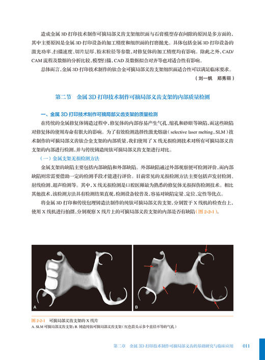 数字化技术在可摘局部义齿修复中的应用 吴江 高勃 金属3D打印技术制作可摘局部义齿基础研究临床应用 口腔修复学 人民卫生出版社 商品图3