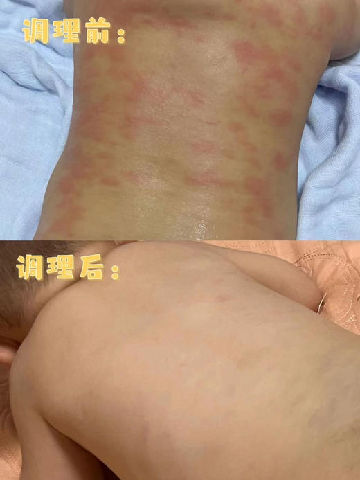 合生元益生菌M-16V白金版36袋一盒288元，现立减50元，活动价238元 商品图6