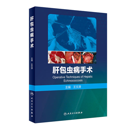 肝包虫病手术 王文涛 寄生虫疾病肝包虫病流行病学特点 临床诊断治疗预防 外科手术方式技巧术后管理 人民卫生出版社9787117315609 商品图1