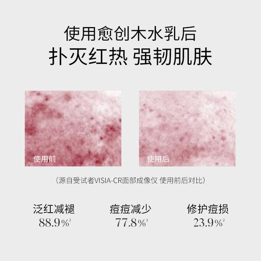 溪木源愈创木抗痘修护精华乳100ml 商品图2