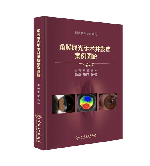 角膜屈光手术并发症案例图解 9787117352697 商品图0