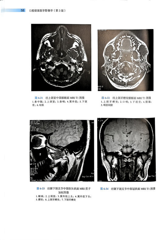 口腔颌面医学影像学 第3版 张祖燕 傅开元 北京大学口腔医学教材 住院医师规范化培训辅导教材 北京大学医学出版社9787565927614 商品图4