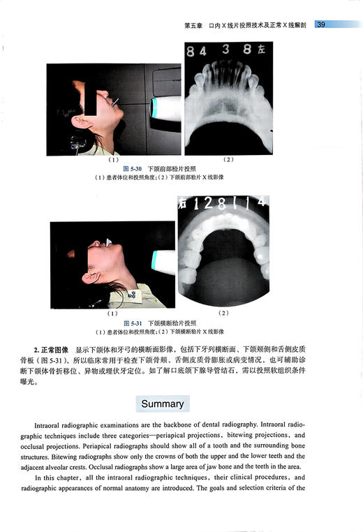 口腔颌面医学影像学 第3版 张祖燕 傅开元 北京大学口腔医学教材 住院医师规范化培训辅导教材 北京大学医学出版社9787565927614 商品图3