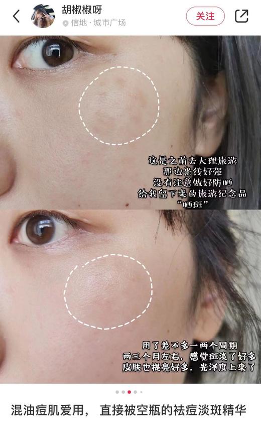 科Y氏淡斑精华中样15ml 商品图9