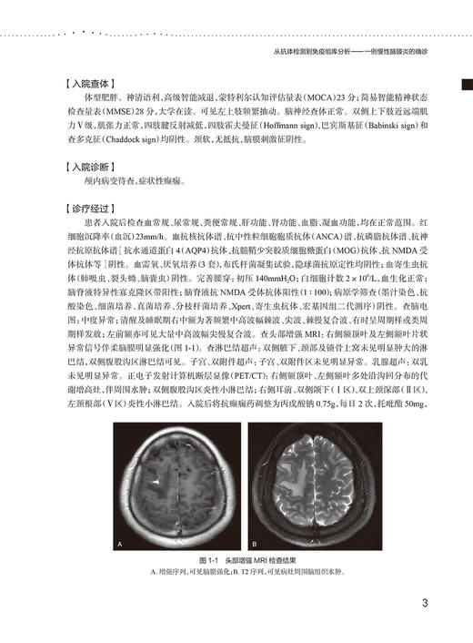 北京协和医院罕见病临床思维与多学科诊疗方案集2023年版 配增值 张抒扬 罕见病诊疗多学科会诊病例集9787117347655人民卫生出版社 商品图4