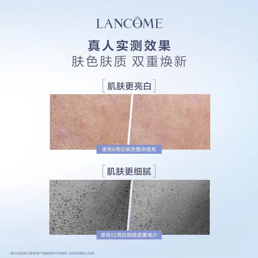 【限时折扣】Lancome兰蔻新品极光焕白精华 商品图3