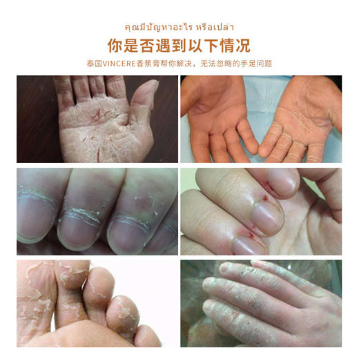 【拍1发3瓶】泰国VINCERE燕窝珍珠香蕉膏 手足裂口、祛老茧、保湿修复、手足脱皮开裂、四季可用 商品图2
