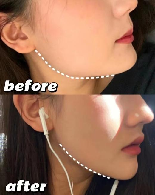 澳大利亚正品EARORON微雕V脸面膜 商品图4