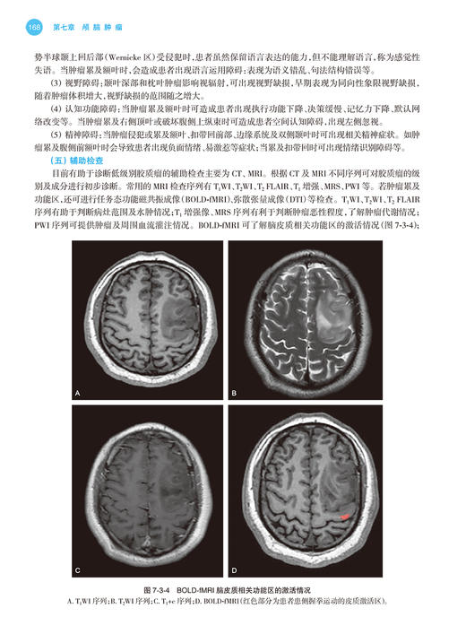 神经外科学 江涛 编 配手术视频 国家卫生健康委员会专科医师培训规划教材 经典案例分析临床知识要点9787117333108人民卫生出版社 商品图4