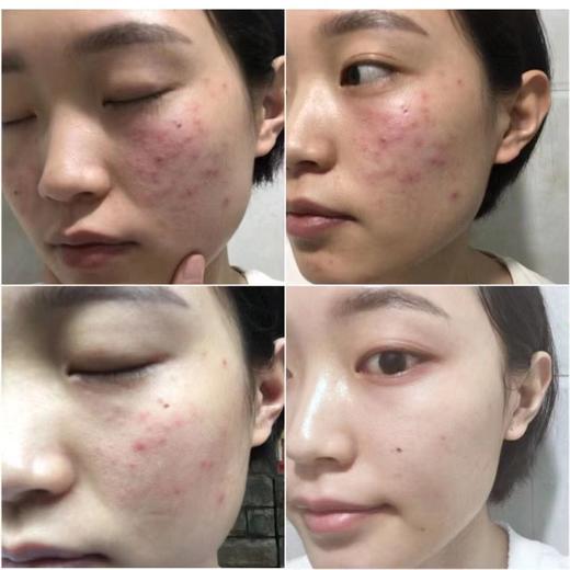 【应季好物】skalka消消豆 三豆茶105g*2盒 商品图4