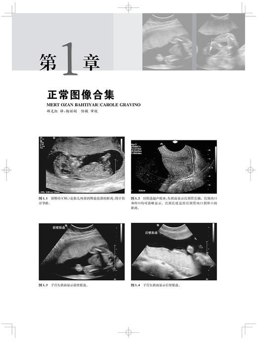 产科影像学 胎儿诊断与监护 影像学大师系列 任敏 周毓青刘宇杰主译 胎儿宫内疾病超声CT等影像学表现诊断治疗 上海科学技术出版社 商品图3