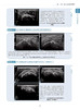 四肢肌骨经典病例超声解析 王月香主编 临床肌骨病例分析 经典超声图像解释 疾病超声诊断要点 科学技术文献出版社9787523504413 商品缩略图4