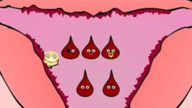  艾友真实反馈：艾灸调理月经不规律，功血问题。 