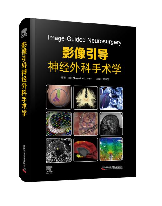 影像引导神经外科手术学 商品图0