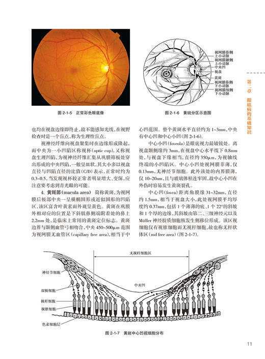 眼底病鉴别诊断学 第2版 魏文斌 陈积中 眼底病鉴别诊断治疗方法 临床误诊误治原因分析防范病例介绍 人民卫生出版社9787117351645 商品图4