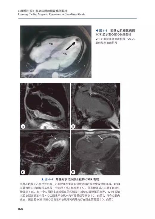 正版现货 心脏磁共振 临床应用教程及病例解析 影像医学书籍 CMR实用教程 CMR临床应用要点 中国科学技术出版社9787522127620 商品图3