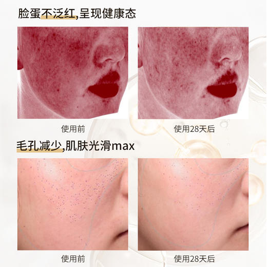 拍1送同款小样5支，拍2送同款小样10支【ZQ-II再启时光抚纹塑颜精华油30ml】御龄紧致淡纹 缓解泛红干燥 商品图2