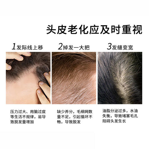 头皮护理洗发水 13种植物精华滋养修复，强韧发质，秀发蓬松丰盈 商品图8