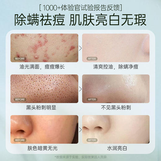 儒意复合酸焕颜洁颜蜜200g 洗面奶 控油除螨  祛痘清洁黑头  收缩毛孔 | 儒意官方商城 商品图1