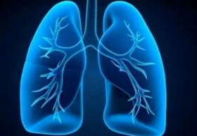  肺不好，寿命短！4个方法养肺排垢，有效远离肺部疾病，阻断肺燥！ 