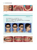 实用儿童正畸特色技术图谱 临床儿童早期矫治应用矫治器佩戴正畸操作规范牙齿矫正方案设计 辽宁科学技术出版社9787559130976 商品缩略图4