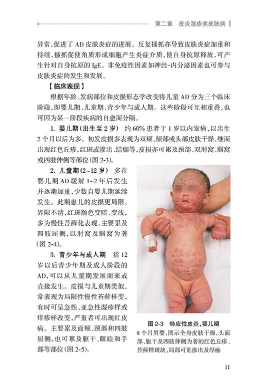 儿童皮肤病诊疗规范 马琳 儿科疾病诊疗规范丛书中华医学会儿科学分会编写 小儿皮肤病生理病理学特点临床诊断治疗 人民卫生出版社 商品图3