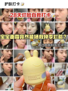 28天打卡！换季烂脸居然被宝宝面霜整好了！