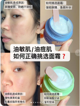 用对不用贵！原来青春期尊嘟可以不长痘！