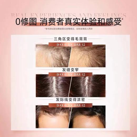 欧莱雅防脱小水枪喷雾固发护发防脱发头皮护理精华液90ml 商品图5