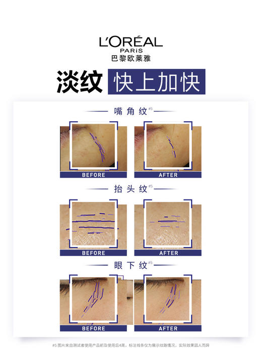 【全球购】【140会员福利】欧莱雅复颜玻尿酸水光充盈全脸淡纹眼霜30ml   商品图5