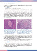 淋巴网状组织病理学 严庆汉 著 淋巴网状组织基本理论知识 淋巴瘤临床病理形态学诊断要点鉴别诊断 人民卫生出版社9787117330411 商品缩略图3