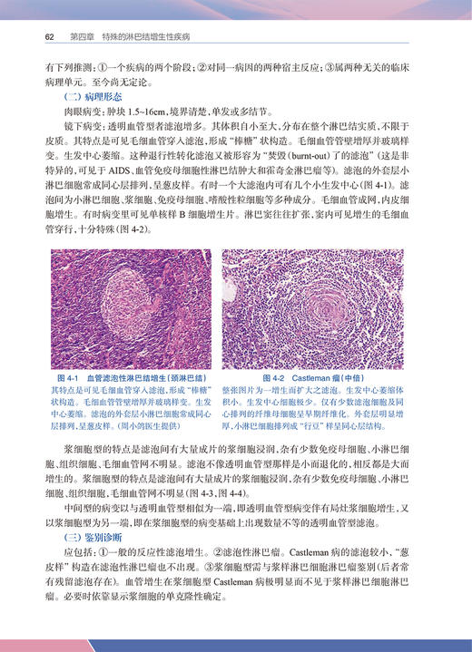 淋巴网状组织病理学 严庆汉 著 淋巴网状组织基本理论知识 淋巴瘤临床病理形态学诊断要点鉴别诊断 人民卫生出版社9787117330411 商品图3