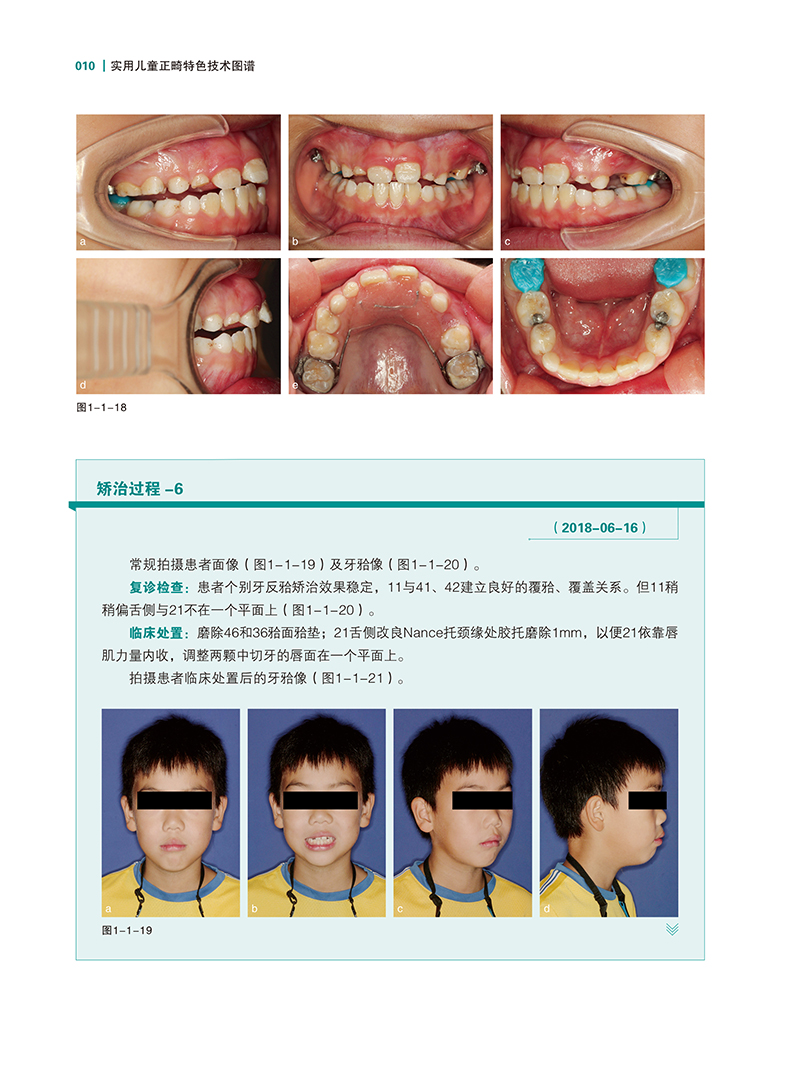 实用儿童正畸特色技术图谱-精彩页-5.jpg
