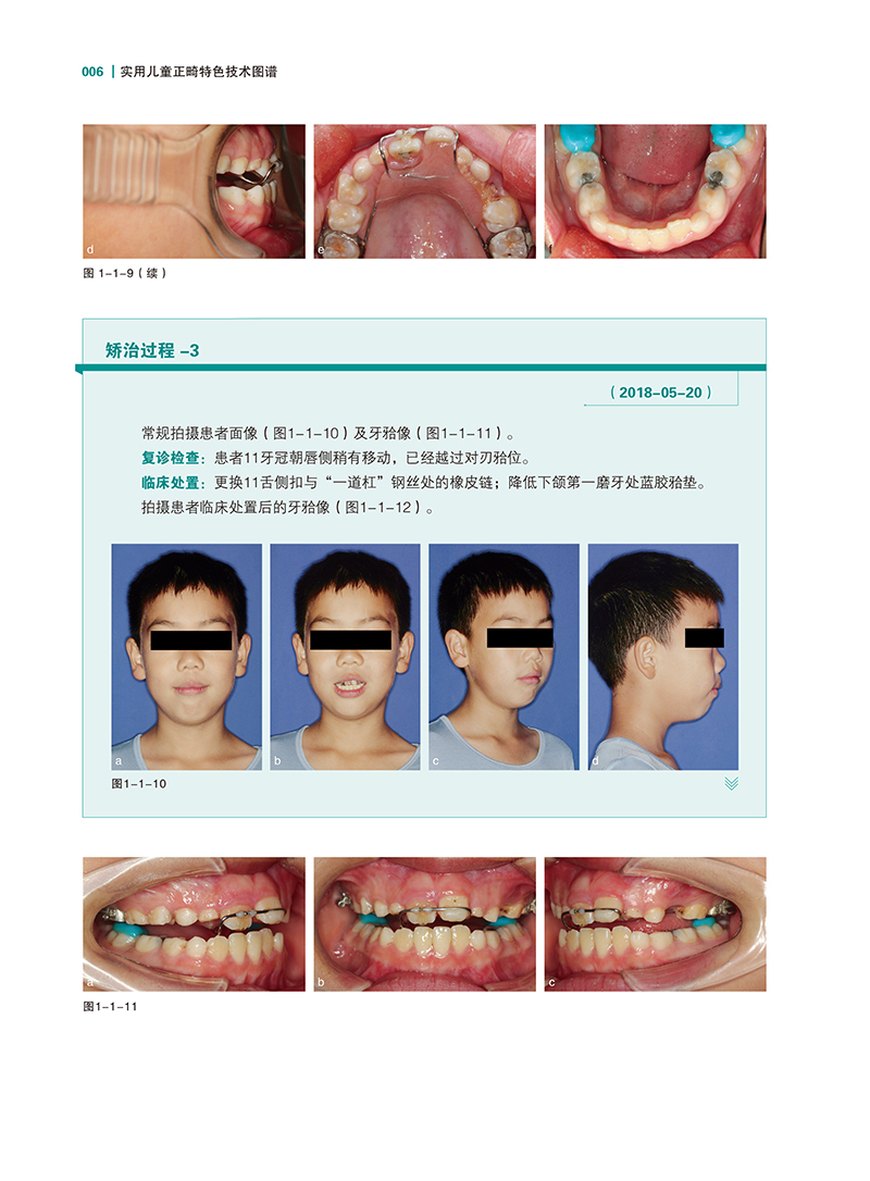 实用儿童正畸特色技术图谱-精彩页-1.jpg