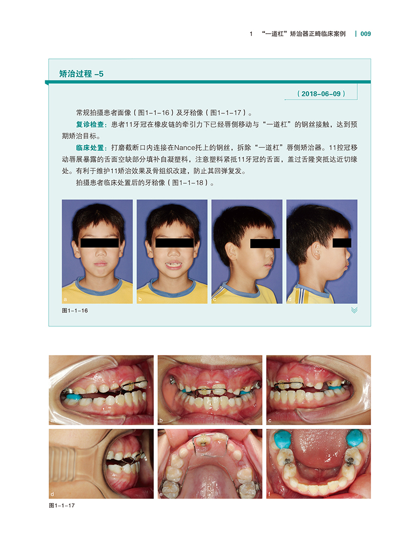 实用儿童正畸特色技术图谱-精彩页-4.jpg
