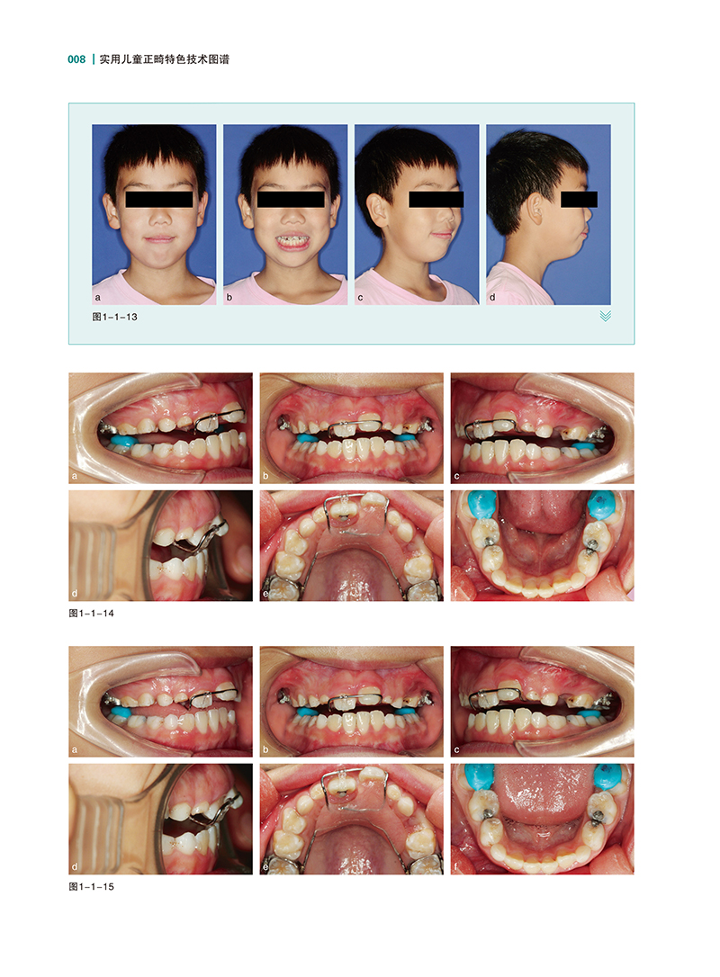 实用儿童正畸特色技术图谱-精彩页-3.jpg