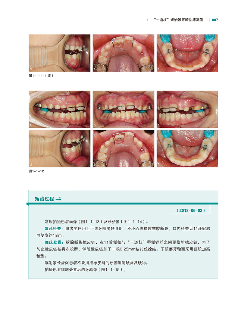 实用儿童正畸特色技术图谱-精彩页-2.jpg